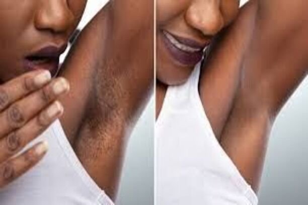 Laseraisselleavantetapres01 (1)